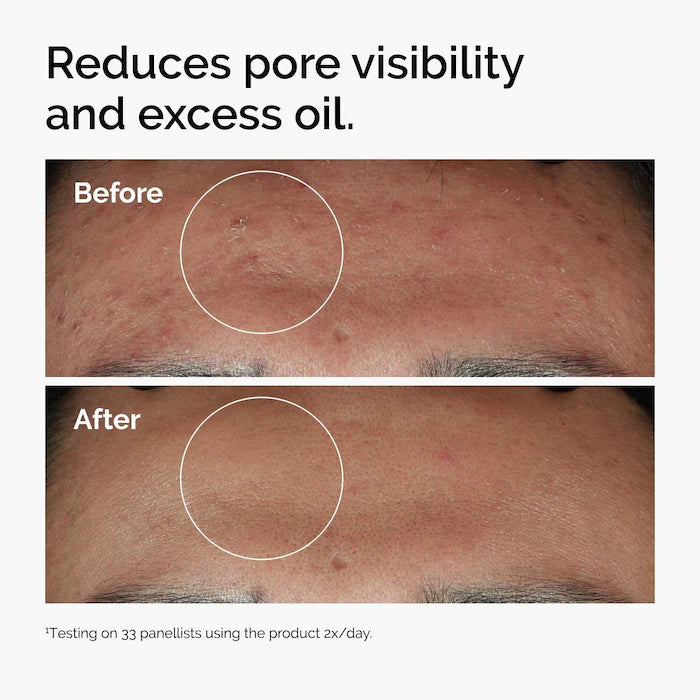 Serum Niacinamida 10% 60 mL - The ordinary