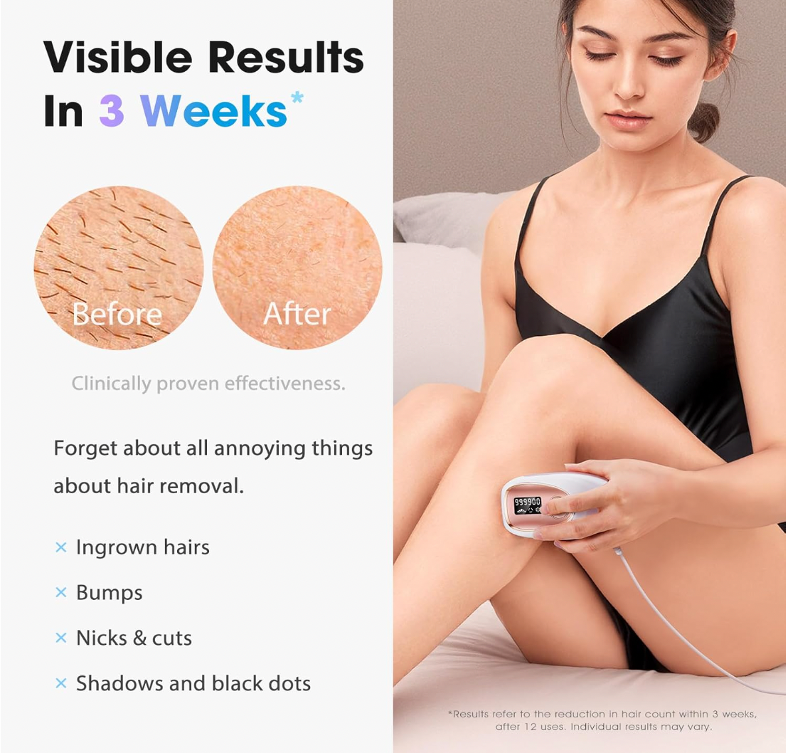 Dispositivo Depilación Láser IPL para Mujeres y Hombres - IPL