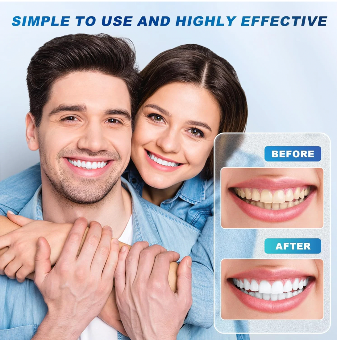 Kit Blanqueamiento Dental: 32 Luces LED + Bolígrafo de Gel